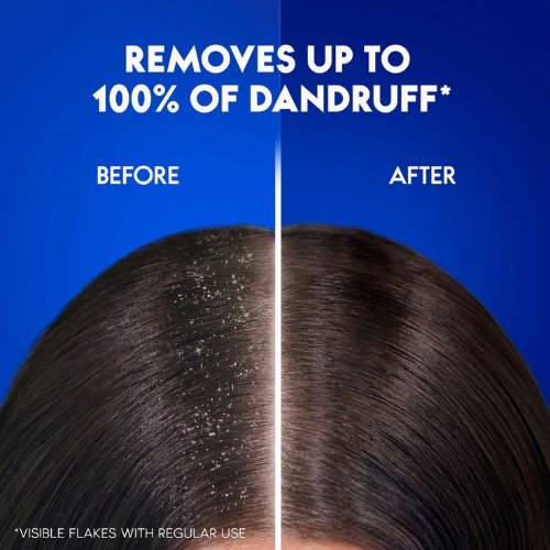 Selsun Blue Dandruff Shampoo Medicated with Menthol product image