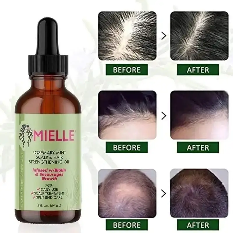 Mielle Rosemary Mint Scalp & Hair Strengthening Oil 59 ml
